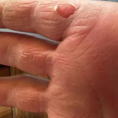Ouch!